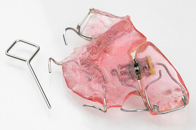 床矯正(しょうきょうせい)