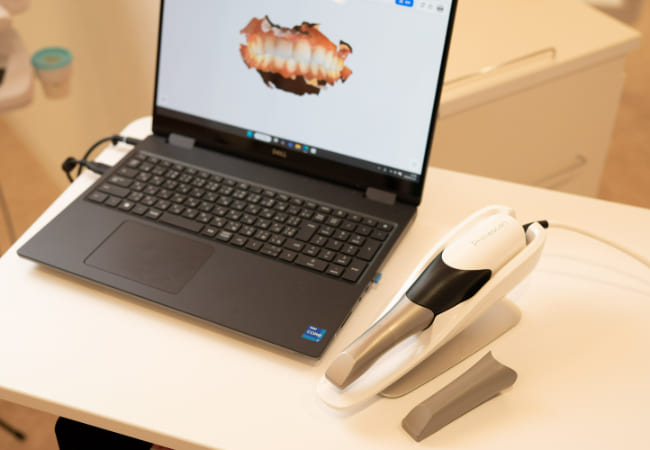 口腔内スキャナー